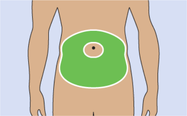 Where To Inject The TRYNGOLZA Autoinjector Where To Inject The TRYNGOLZA Autoinjector