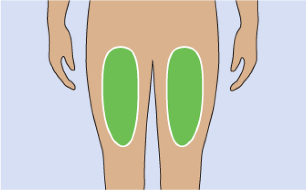 Where To Inject The TRYNGOLZA Autoinjector Where To Inject The TRYNGOLZA Autoinjector