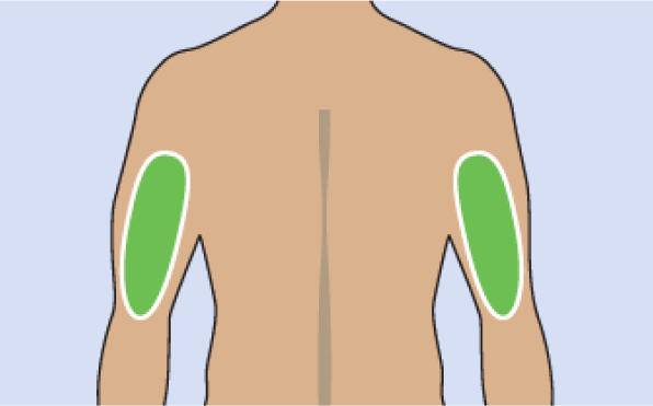 Where To Inject The TRYNGOLZA Autoinjector Where To Inject The TRYNGOLZA Autoinjector