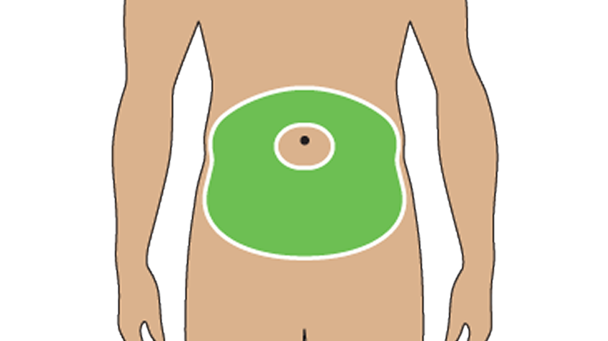Illustration of Where To Inject The TRYNGOLZA Autoinjector: Abdomen