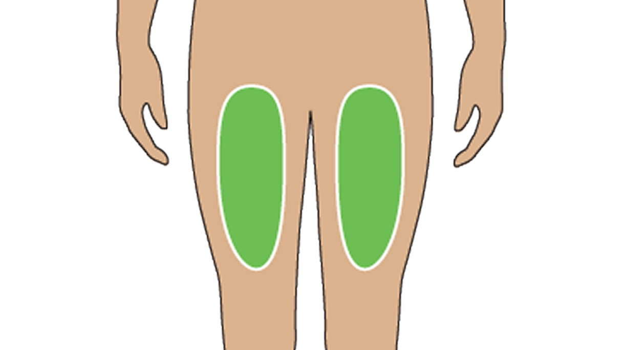 Illustration of Where To Inject The TRYNGOLZA Autoinjector: Front of the Thigh