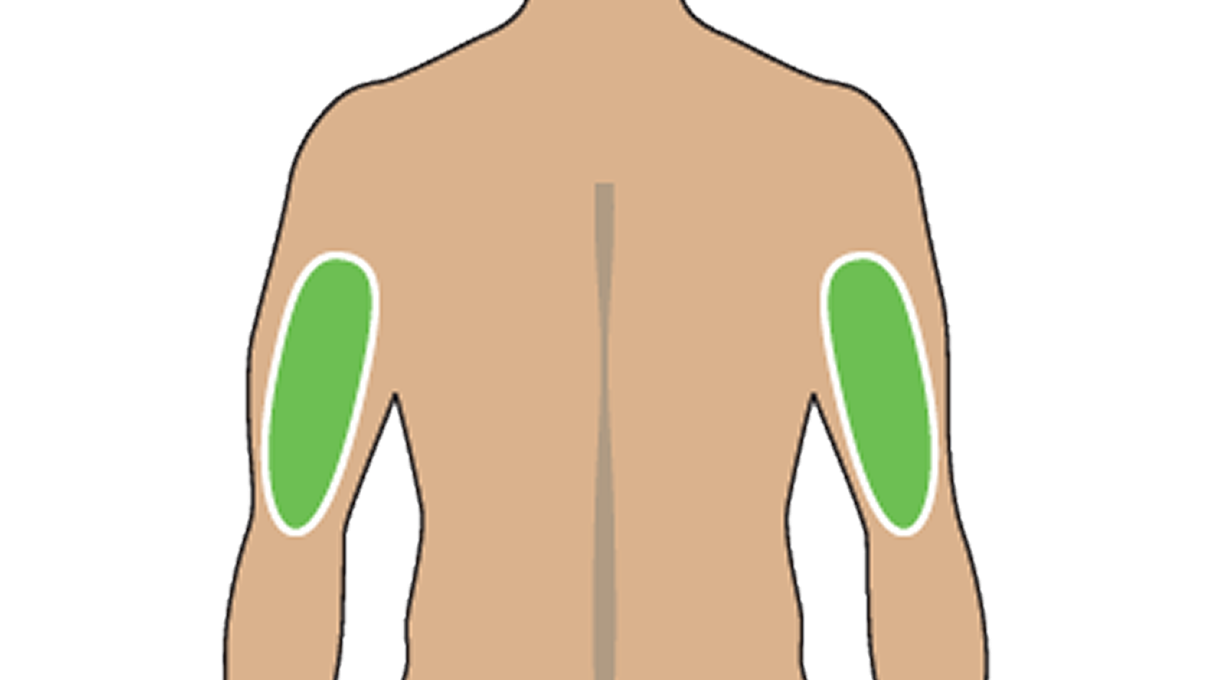 Illustration of Where To Inject The TRYNGOLZA Autoinjector: Back of the Upper Arm