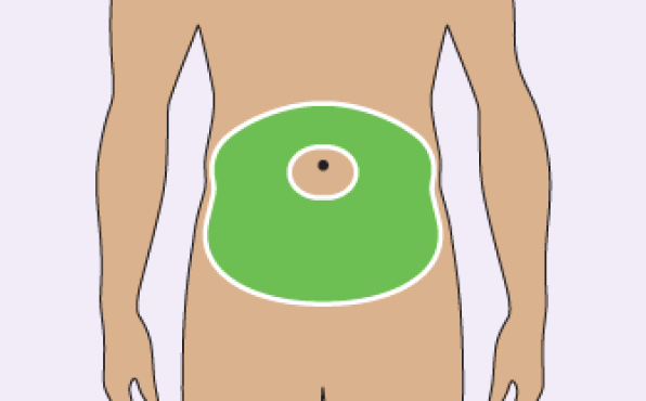 Illustration of Where To Inject The TRYNGOLZA Autoinjector: Abdomen