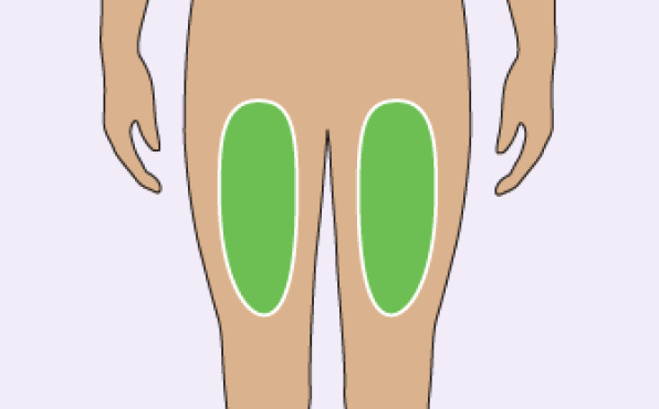 Illustration of Where To Inject The TRYNGOLZA Autoinjector: Front of the Thigh